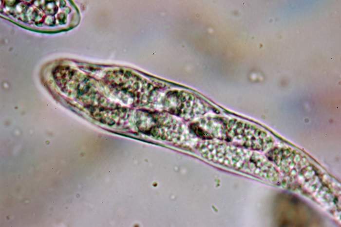 macrostoma
