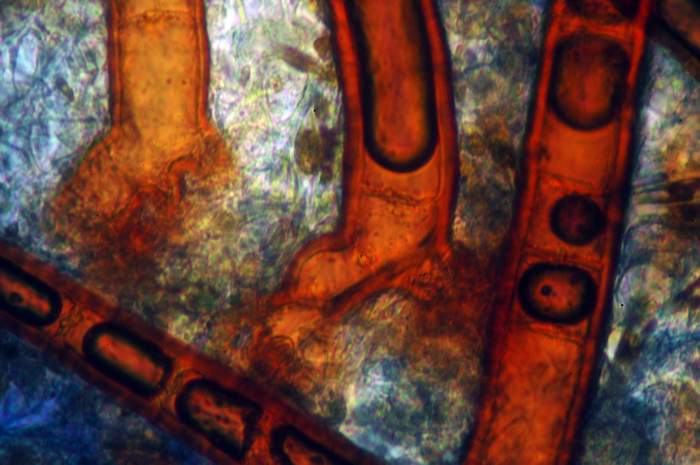 macrostoma