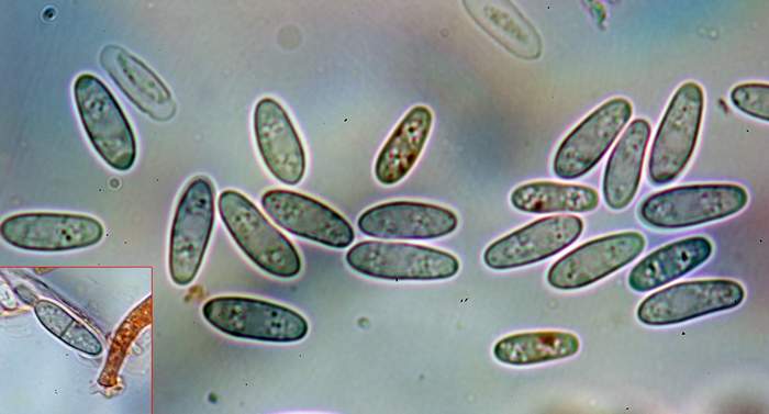 macrostoma