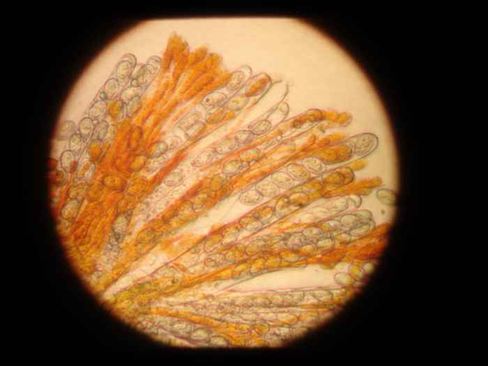 macrostoma
