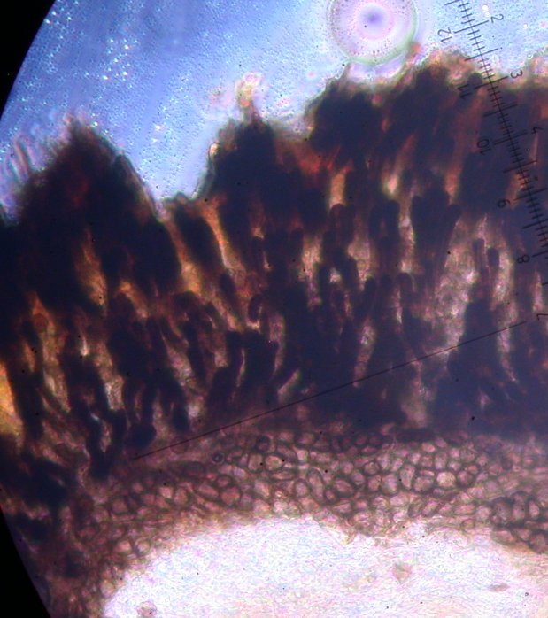 macrostoma