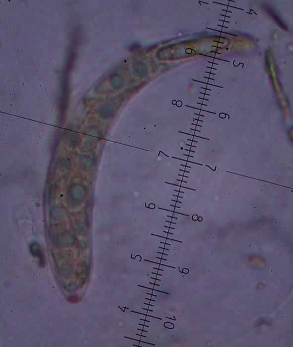 macrostoma
