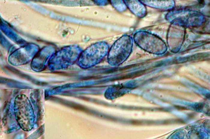 macrostoma