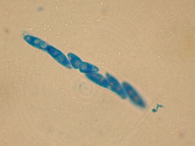 macrostoma