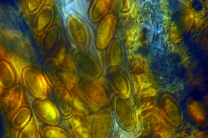macrostoma