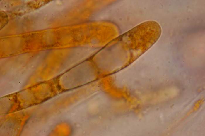 macrostoma