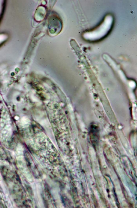 macrostoma