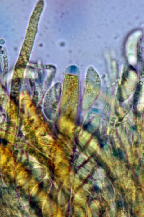 macrostoma