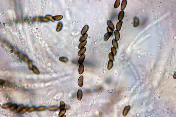 macrostoma