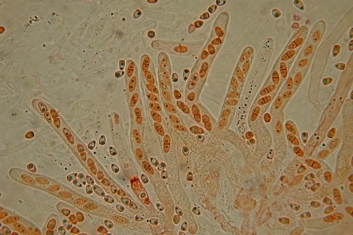 macrostoma