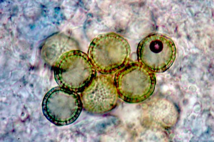 macrostoma
