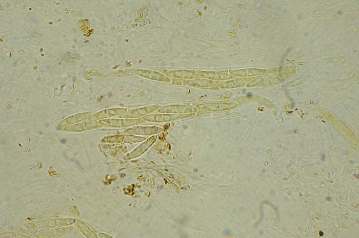 macrostoma