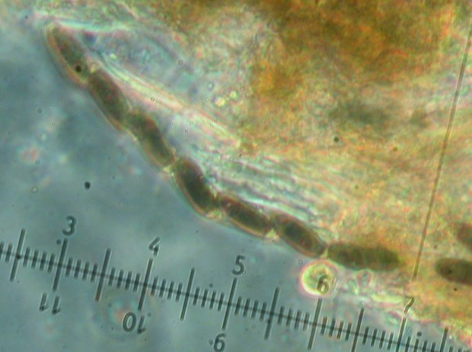 macrostoma