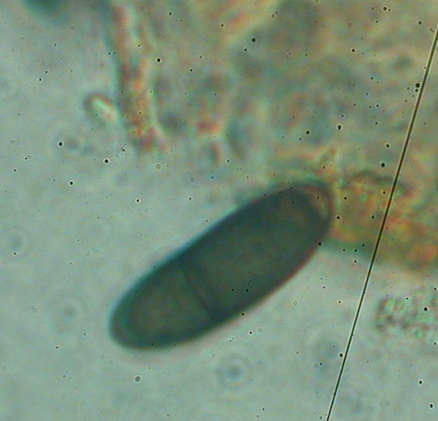 macrostoma