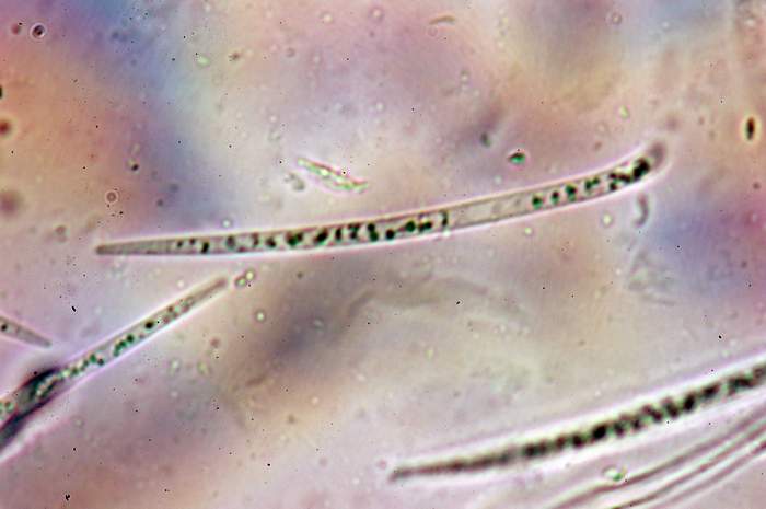 macrostoma