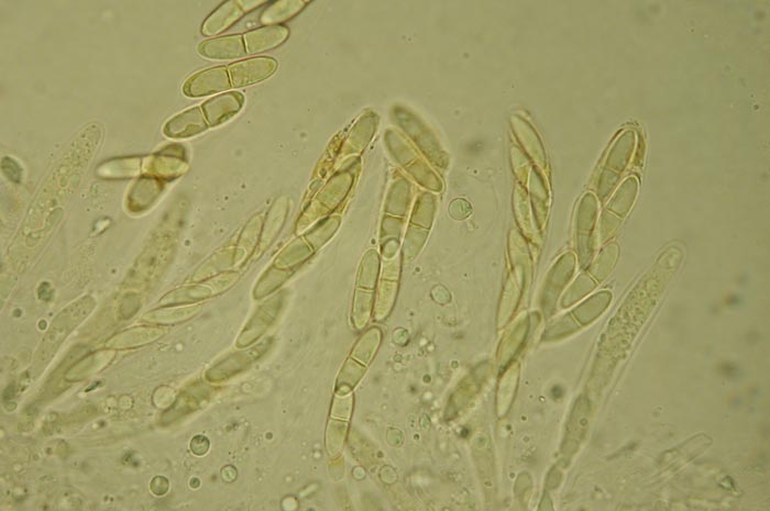 macrostoma