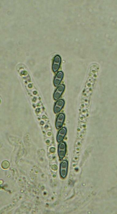 macrostoma