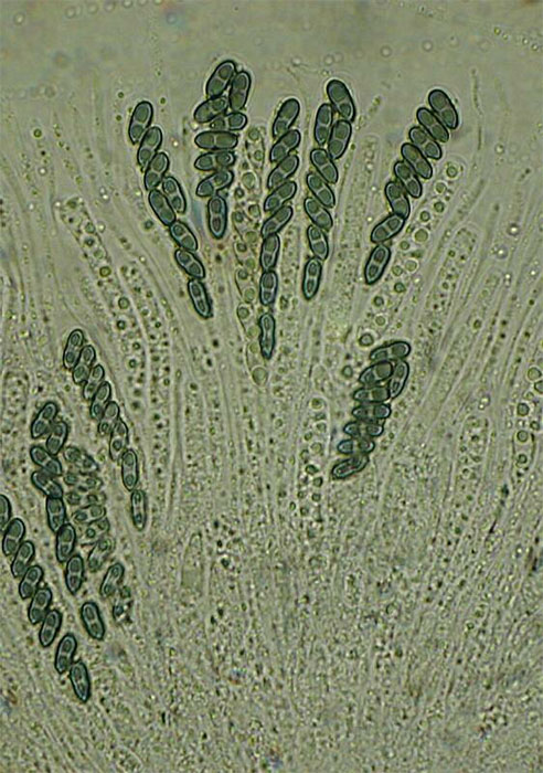 macrostoma