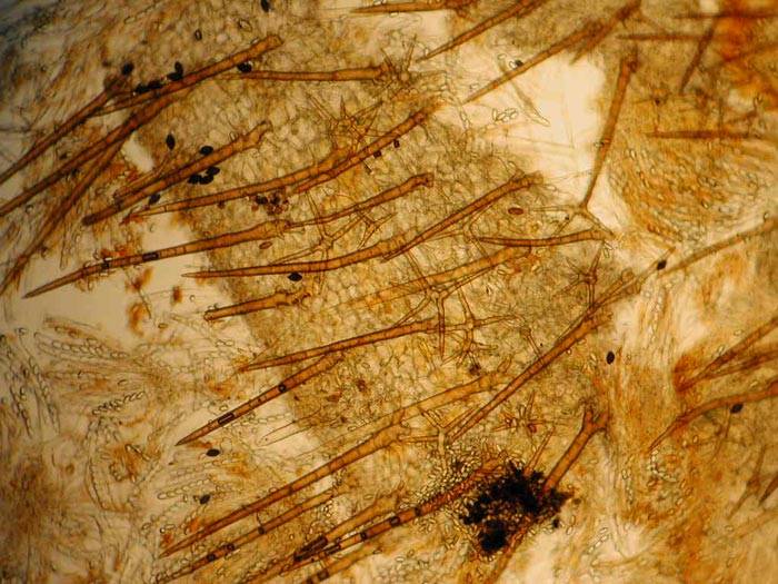 macrostoma
