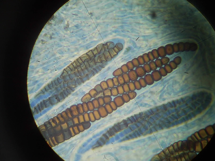 macrostoma