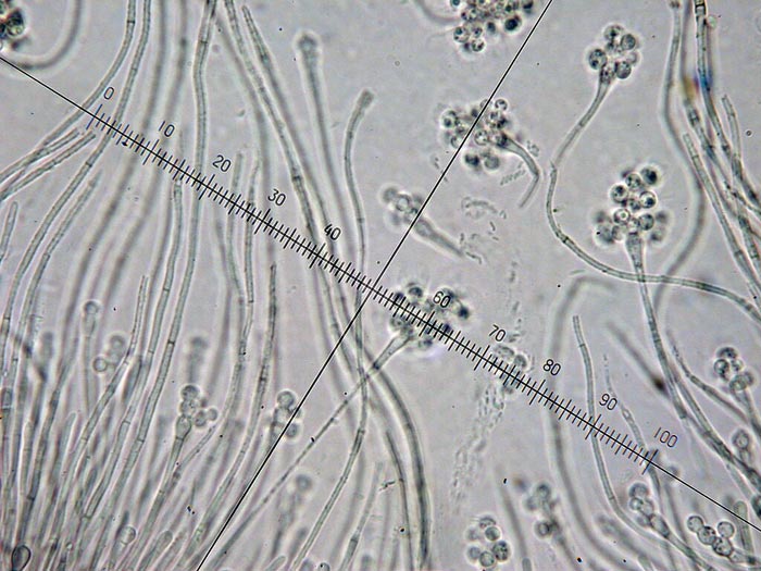 macrostoma