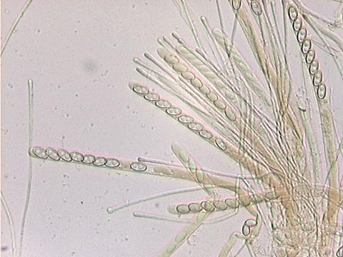 macrostoma