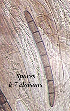 macrostoma