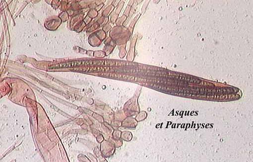 macrostoma