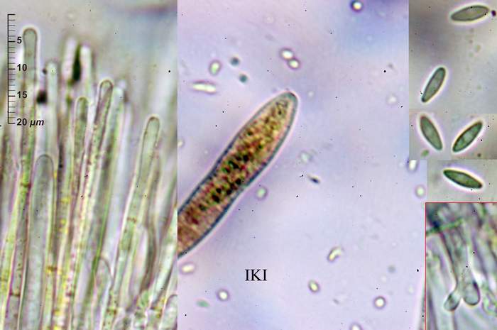macrostoma