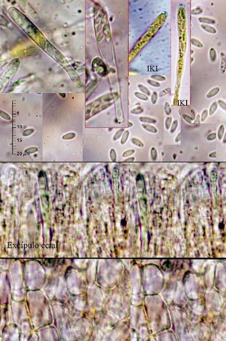 macrostoma