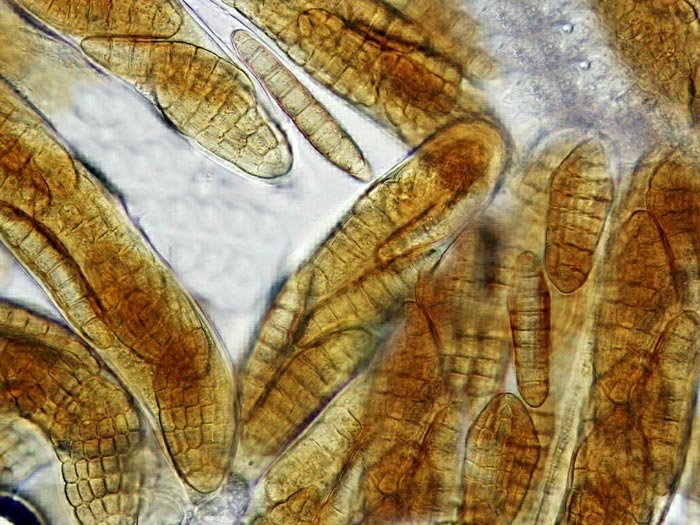 macrostoma