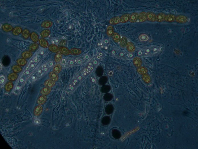 macrostoma