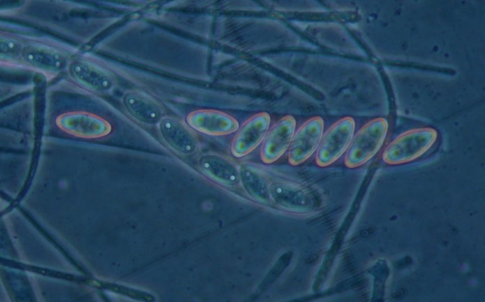 macrostoma