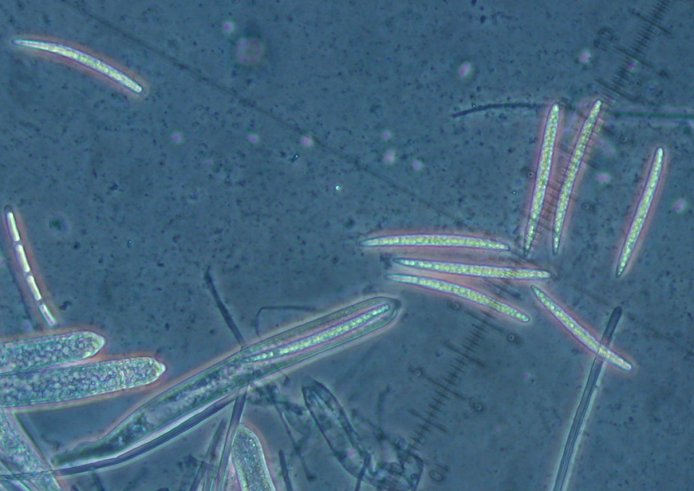 macrostoma