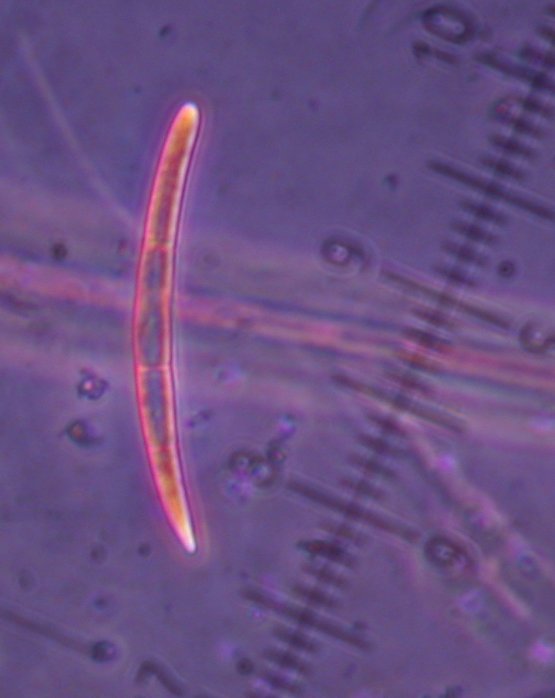 macrostoma