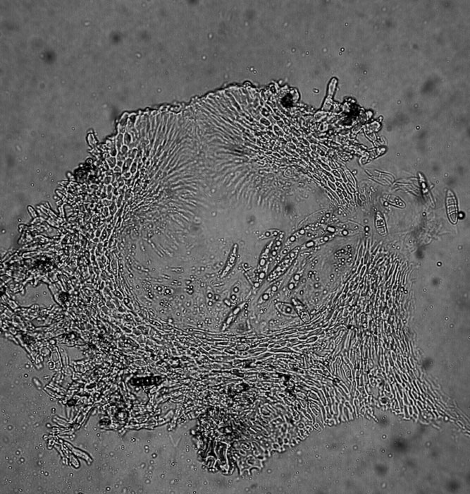 macrostoma