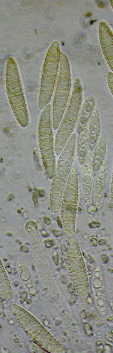 macrostoma