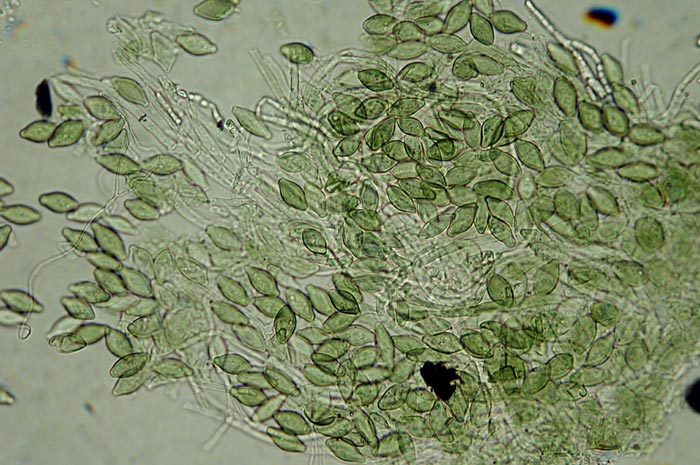 macrostoma