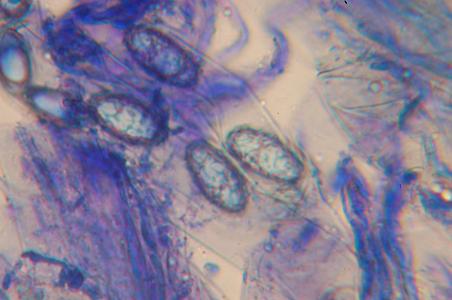 macrostoma