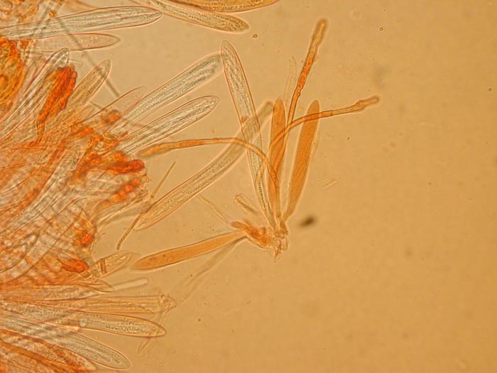 macrostoma