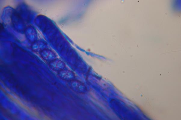 macrostoma