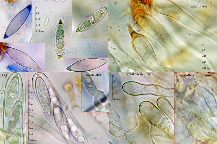 macrostoma
