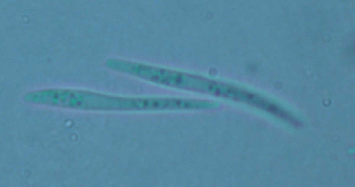 macrostoma