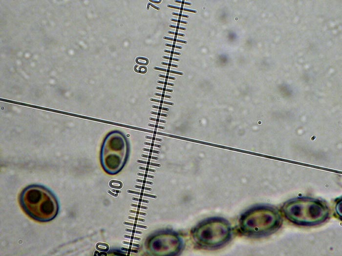 macrostoma