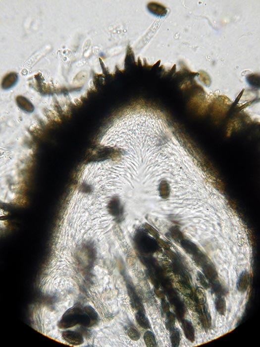 macrostoma