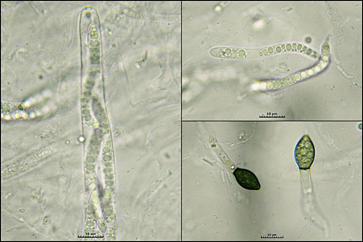 macrostoma