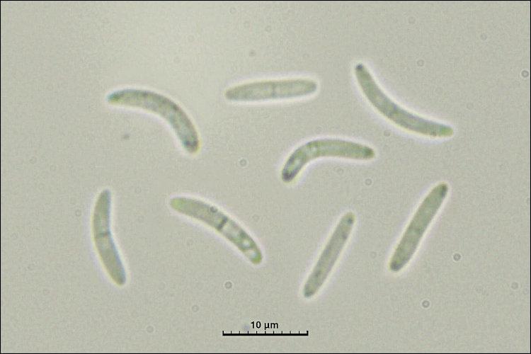 macrostoma