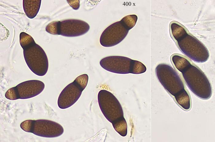 macrostoma