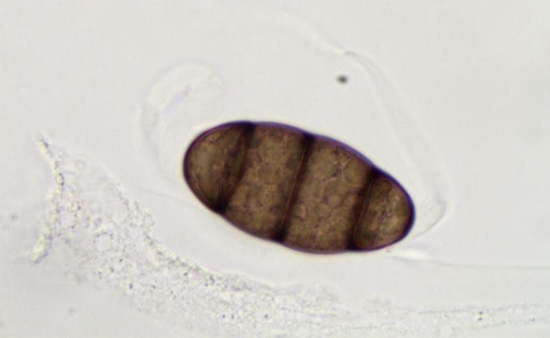 macrostoma