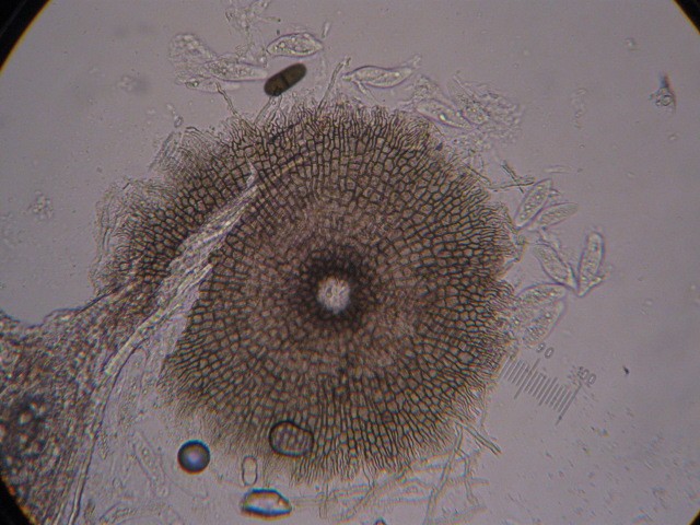 macrostoma